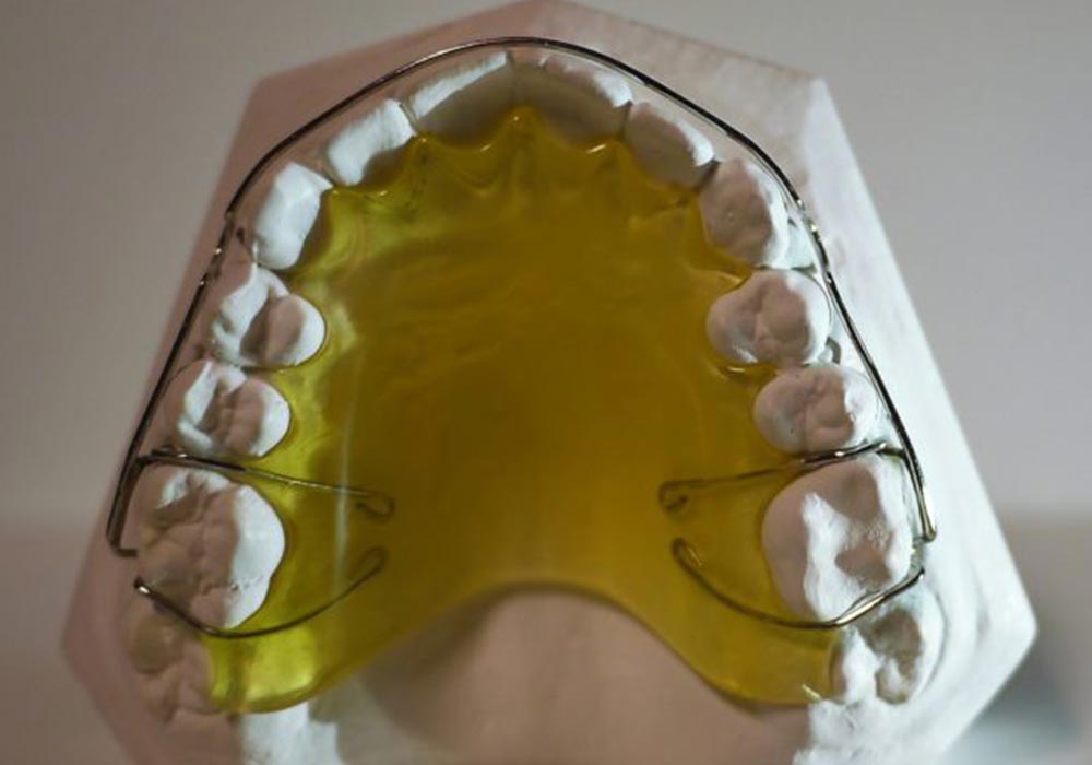 Ortodonti-5